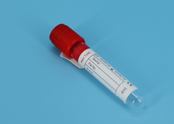 Edta Vacuum Blood Collection Tube Medical Serum Blood Test Vacuum Tubes